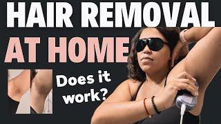 Ultimate IPL HAIR REMOVAL At Home | Ulike Air 10 Hair Removal Routine | Is It Worth It?