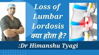 Loss of Lumbar lordosis क्या होता है?