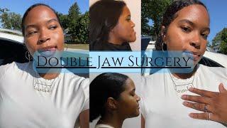 VLOG #3: My face lifttt aka Double Jaw Surgery