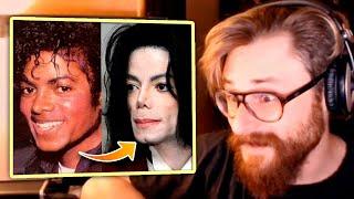 ¿Se operó Michael Jackson para cambiar el color de su piel? Experto en el cantante lo explica