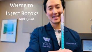 Where to Inject Botox? And Q&A!