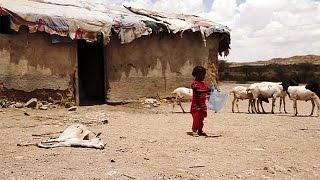Глаза голода в Сомали