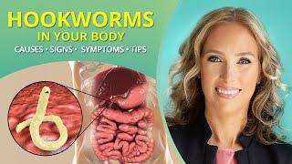 Hookworms | Causes, Signs, Symptoms, & Tips #parasites | Dr. J9 Live